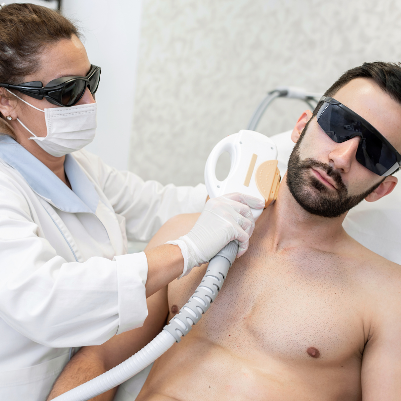 Laser hair deals removal for men